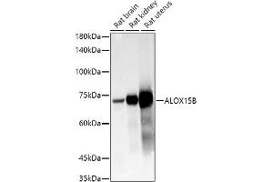 Western blot analysis of extracts of various cell lines, using B antibody (ABIN6129899, ABIN6136816, ABIN6136817 and ABIN6222589) at 1:1000 dilution. (ALOX15B antibody  (AA 1-200))
