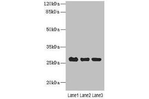 Western blot All lanes: C10orf82 antibody at 1 μg/mL Lane 1: A431 whole cell lysate Lane 2: HepG2 whole cell lysate Lane 3: Mouse thymus tissue Secondary Goat polyclonal to rabbit IgG at 1/10000 dilution Predicted band size: 27, 18, 13 kDa Observed band size: 27 kDa (RPAP2 antibody  (AA 1-154))