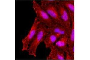 Immunofluorescenitrocellulosee of human HeLa cells stained with monoclonal anti-human KCDT15 antibody (1:500) with Texas Red (Red). (KCTD15 antibody)