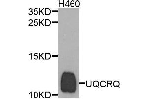 Western blot analysis of extracts of H460 cells, using UQCRQ antibody. (UQCRQ antibody)