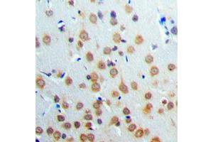 Immunohistochemical analysis of ANKRD20A3 staining in human brain formalin fixed paraffin embedded tissue section. (ANKRD20A3 antibody  (Center))