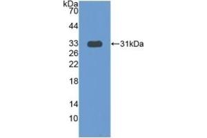 Detection of Recombinant COIL, Human using Polyclonal Antibody to Coilin (COIL) (Coilin antibody  (AA 319-538))
