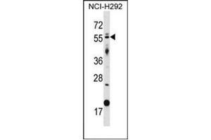 Western blot analysis of GLIS2 Antibody (GLIS2 antibody  (Middle Region))