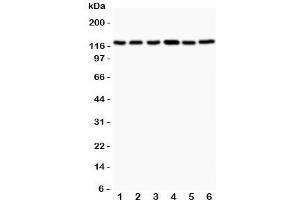 Western blot testing of Bub1 antibody and Lane 1:  rat testis;  2: (r) ovary;  3: (r) liver;  4: human Jurkat;  5: (h) COLO320;  6: (h) HEPG2. (BUB1 antibody  (AA 731-1085))