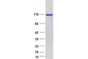 Validation with Western Blot