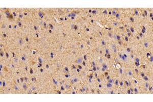 Detection of TUBb6 in Mouse Cerebrum Tissue using Polyclonal Antibody to Tubulin Beta 6 (TUBb6) (TUBb6 antibody  (AA 194-421))