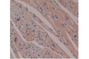 DAB staining on IHC-P Samples:Mouse Heart Tissue) (beta-2 Microglobulin antibody  (AA 22-119))