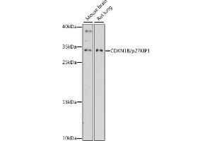 Western blot analysis of extracts of various cell lines, using CDKN1B/p27KIP1 antibody (ABIN7266603) at 1:3000 dilution. (CDKN1B antibody  (AA 1-100))