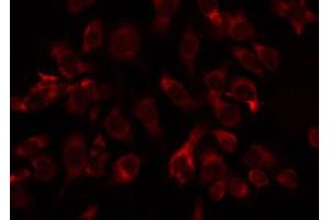 ABIN6274787 staining COLO205 by IF/ICC. (ABHD11 antibody  (C-Term))