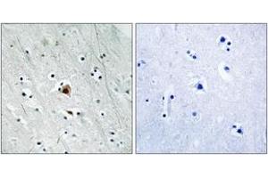 Immunohistochemistry analysis of paraffin-embedded human brain, using MAPKAPK2 (Phospho-Ser272) Antibody. (MAPKAP Kinase 2 antibody  (pSer272))