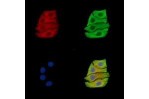 ABIN7096367 and ABIN7100430 staining Hela cells by IF/ICC.