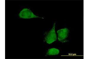 Immunofluorescence of purified MaxPab antibody to KLHDC4 on HeLa cell. (KLHDC4 antibody  (AA 1-520))