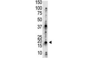 Western Blotting (WB) image for anti-Ubiquitin-Conjugating Enzyme E2G 2 (UBE2G2) antibody (ABIN3001458)