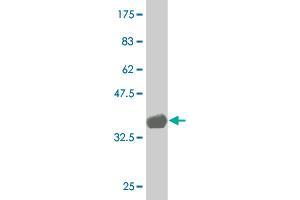 HOXC4 antibody  (AA 160-264)