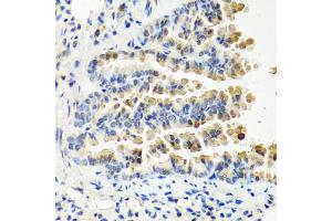 Immunohistochemistry of paraffin-embedded mouse lung using NTF3 antibody (ABIN6290616) at dilution of 1:100 (40x lens).