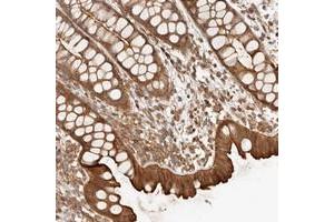Immunohistochemical staining of human rectum with UFSP1 polyclonal antibody  shows strong cytoplasmic an membranous positivity in glandular cells.