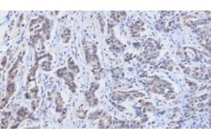 Immunohistochemistry (IHC) image for anti-Retinol Binding Protein 4, Plasma (RBP4) (AA 19-201) antibody (ABIN356230) (RBP4 antibody  (AA 19-201))