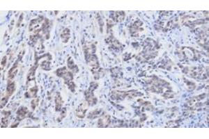 Immunohistochemistry (IHC) image for anti-Retinol Binding Protein 4, Plasma (RBP4) (AA 19-201) antibody (ABIN356230)