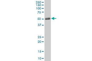 MMP1 MaxPab polyclonal antibody. (MMP1 antibody  (AA 1-469))