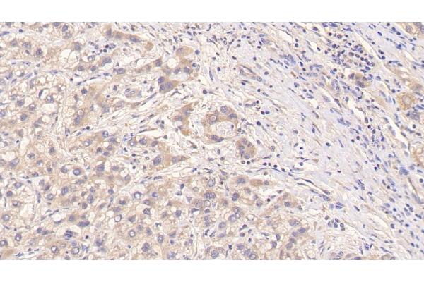 PIIINP antibody