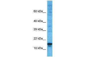 Host:  Rabbit  Target Name:  PRDM5  Sample Type:  ACHN Whole Cell lysates  Antibody Dilution:  1. (PRDM5 antibody  (N-Term))