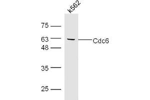 K562 cell lysates probed with Rabbit Anti-Cdc6 Polyclonal Antibody, Unconjugated  at 1:500 for 90 min at 37˚C. (CDC6 antibody)