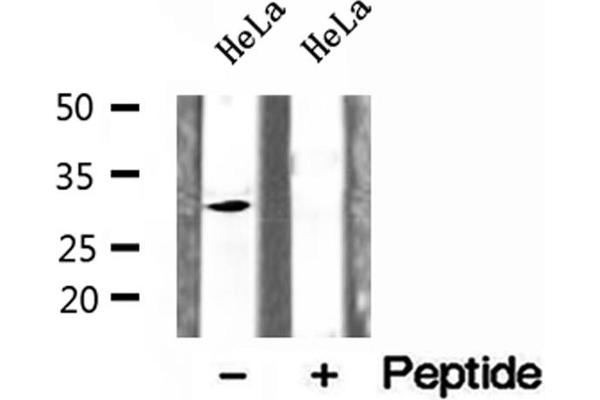 CHMP2A antibody  (Internal Region)