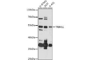 Western blot analysis of extracts of various cell lines, using TRIM11 antibody (ABIN6132732, ABIN6149500, ABIN6149501 and ABIN6218047) at 1:3000 dilution.