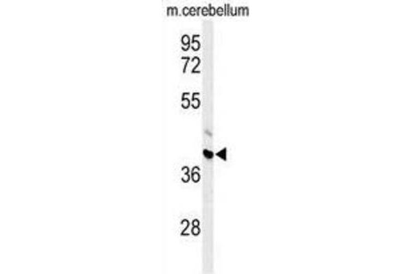 ABHD12 antibody