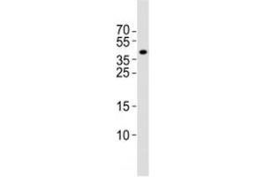 Western Blotting (WB) image for anti-ISL LIM Homeobox 1 (ISL1) (C-Term) antibody (ABIN3028770)