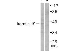 Western blot analysis of extracts from LOVO cells, using Keratin 19 antibody (ABIN5976439). (Cytokeratin 19 antibody  (Internal Region))