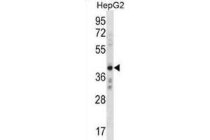 Western Blotting (WB) image for anti-AE Binding Protein 2 (AEBP2) antibody (ABIN3000396) (AEBP2 antibody)