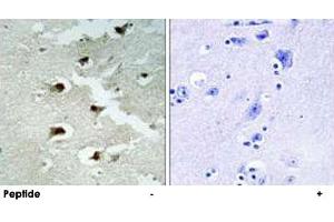 Immunohistochemistry analysis of paraffin-embedded human brain tissue using CDCA4 polyclonal antibody .