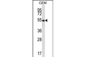GAB Antibody (Center) (ABIN657961 and ABIN2846907) western blot analysis in CEM cell line lysates (35 μg/lane). (GABPA antibody  (AA 283-311))