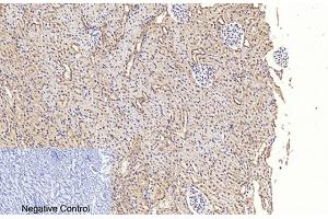 Immunohistochemical analysis of paraffin-embedded rat kidney tissue. (Caspase 3 p17 (AA 100-180), (Cleaved-Asp175) antibody)