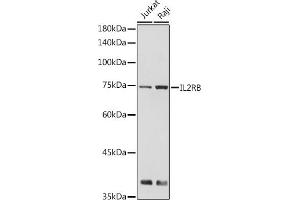Western blot analysis of extracts of various cell lines, using IL2RB antibody (ABIN6127567, ABIN6142376, ABIN6142377 and ABIN6221796) at 1:500 dilution. (IL2 Receptor beta antibody  (AA 27-240))