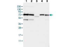 Western blot analysis of Lane 1: RT-4, Lane 2: U-251 MG, Lane 3: Human Plasma, Lane 4: Liver, Lane 5: Tonsil with TRIOBP polyclonal antibody  at 1:250-1:500 dilution.