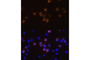 Immunofluorescence analysis of L929 cells using SW antibody (ABIN7270654) at dilution of 1:100. (SWAP70 antibody  (AA 316-585))