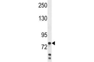 Anti-Myeloperoxidase antibody western blot analysis in MDA-MB231 lysate. (Myeloperoxidase antibody  (AA 420-448))