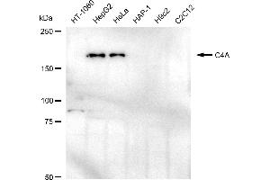 Western blotting analysis using C4A antibody (ABIN7798143).