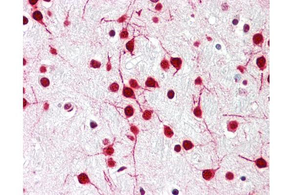 DELE1/KIAA0141 antibody  (N-Term)