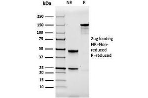 SDS-PAGE Analysis Purified Calbindin 1 Mouse Monoclonal Antibody (CALB1/2364). (CALB1 antibody  (AA 7-96))