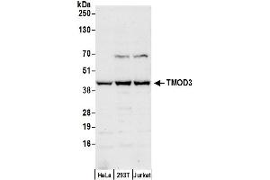 anti-Tropomodulin 3 (TMOD3) (AA 150-200) antibody