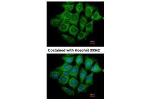 ICC/IF Image Immunofluorescence analysis of methanol-fixed Hep3B, using UBE4B, antibody at 1:500 dilution. (UBE4B antibody  (C-Term))