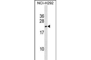 DYDC2 Antibody (C-term) (ABIN1536711 and ABIN2850314) western blot analysis in NCI- cell line lysates (35 μg/lane). (DYDC2 antibody  (C-Term))