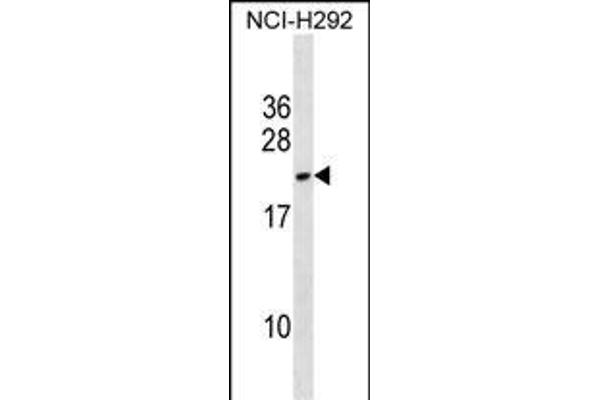 DYDC2 antibody  (C-Term)