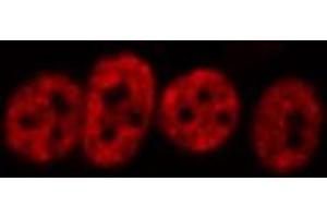 ABIN6266456 staining HeLa  cells by IF/ICC. (HNRNPD/AUF1 antibody  (pSer83))