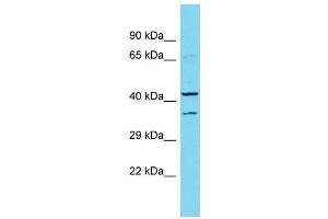 Host:  Rabbit  Target Name:  Dmbx1  Sample Type:  Rat Pancreas lysates  Antibody Dilution:  1. (DMBX1 antibody  (Middle Region))