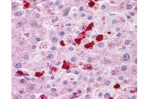 Immunohistochemistry (IHC) image for anti-Leucine Rich Repeat Containing 8 Family, Member B (LRRC8B) (Middle Region) antibody (ABIN502806) (LRRC8B antibody  (Middle Region))