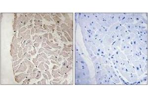 Immunohistochemistry analysis of paraffin-embedded human heart tissue, using Collagen VI alpha1 Antibody. (COL6A1 antibody  (AA 191-240))